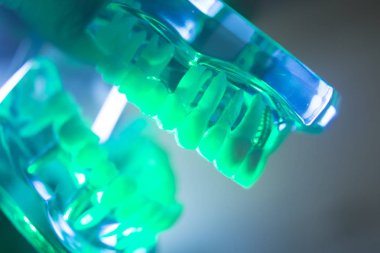 Diş ağız diş modeli