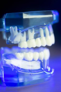Diş diş klinik modeli
