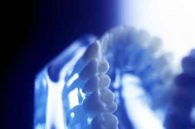 Diş diş çürümesi modeli