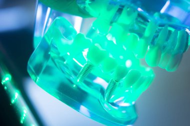 Diş ağız diş modeli