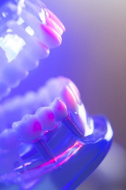 Diş sağlıklı diş modeli