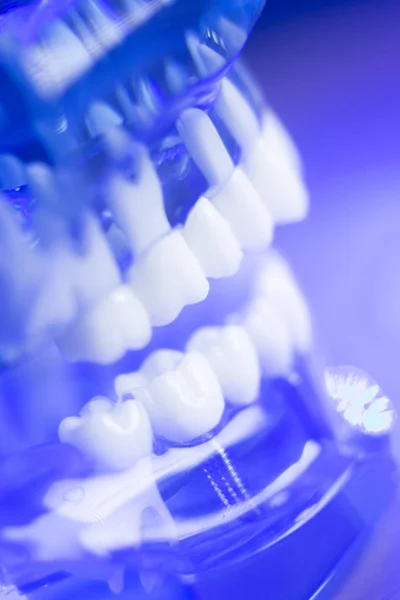 Modello di denti di allineamento dentale — Foto Stock