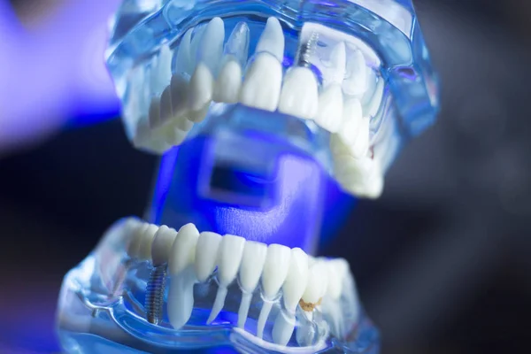 Diş diş ağız sağlığı — Stok fotoğraf