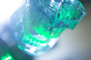 Diş ağız diş modeli