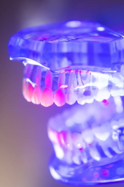 Diş sağlıklı diş modeli