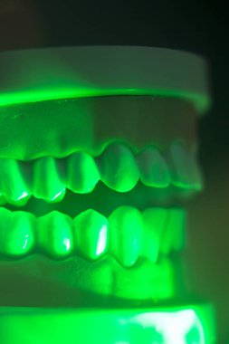 Diş diş çene modeli