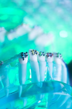 Diş diş köşeli metal