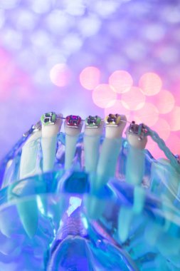 Diş diş köşeli metal