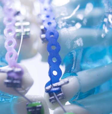 Diş diş köşeli metal