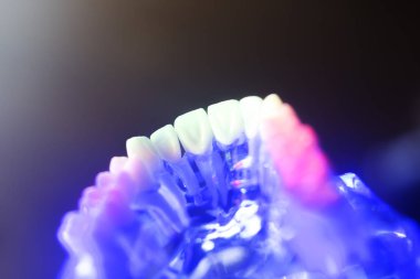 Diş sağlıklı diş modeli