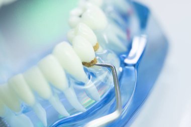 Diş diş dişçi modeli