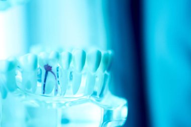 Diş diş ağız modeli