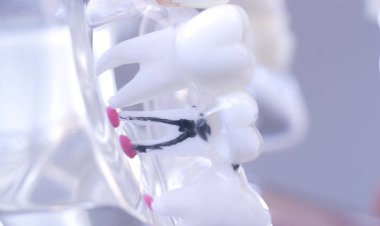 Diş diş ağız modeli