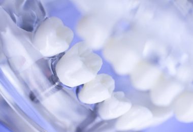 Diş diş ağız modeli