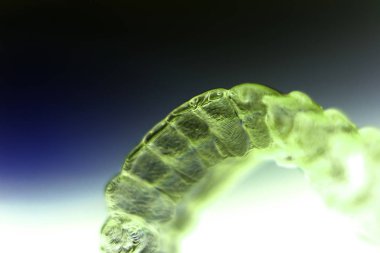 Görünmez diş diş telini