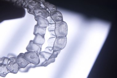 Görünmez diş aligners diş telleri