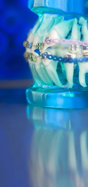 Dental tänder metall fästen — Stockfoto