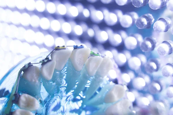 Diş diş köşeli metal