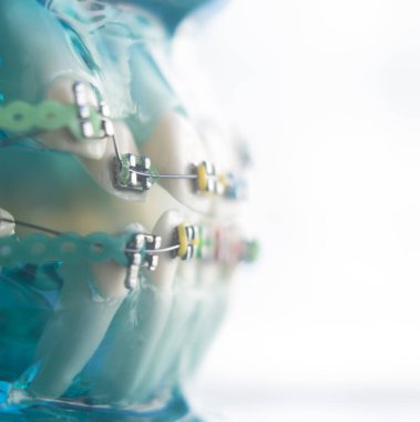 Diş diş köşeli metal