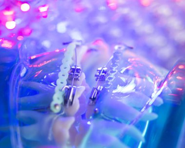 Diş diş köşeli metal