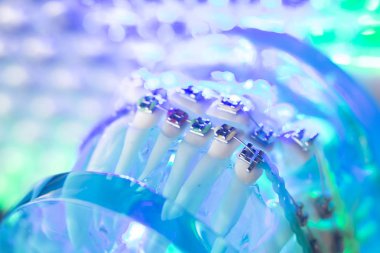 Diş diş köşeli metal