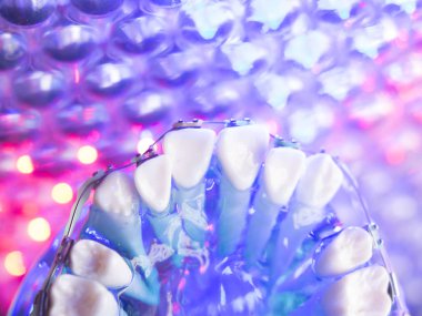 Diş diş köşeli metal