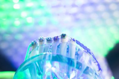 Diş diş köşeli metal