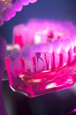 Diş ağız diş modeli