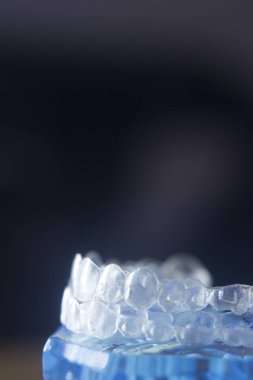 Diş diş bracets modeli