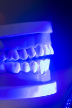 Diş diş çene modeli