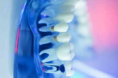 Diş diş diş hekimleri modeli