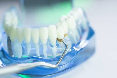 Diş diş dişçi modeli