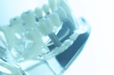 Diş diş ağız modeli