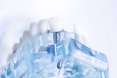 Dentsts diş diş modeli