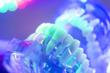 Ortodontik diş diş modeli