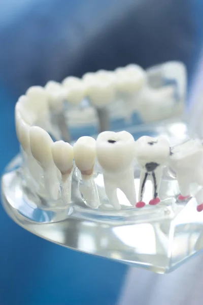 치과 치아 입 모델 — 스톡 사진