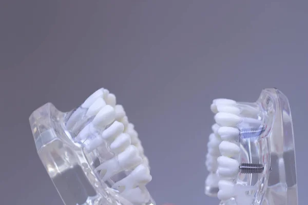 Modelo de boca de dientes dentales —  Fotos de Stock