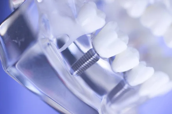 Diş diş ağız modeli