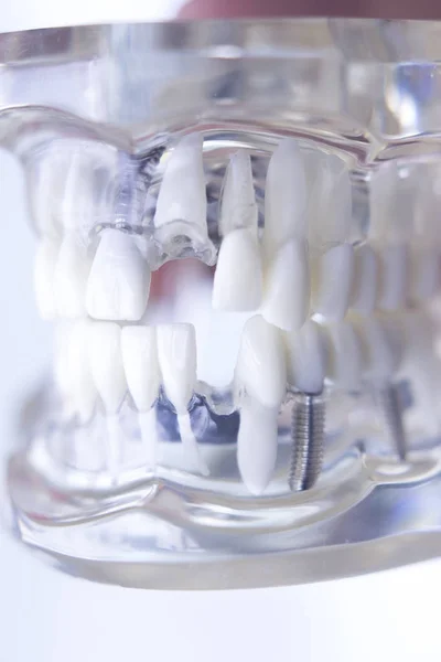 Dentsts zębów dentystycznych modelu — Zdjęcie stockowe