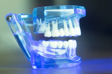 Diş hizalama diş modeli