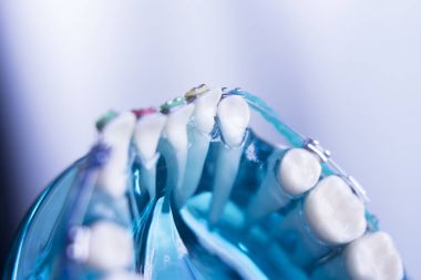 Diş diş köşeli metal