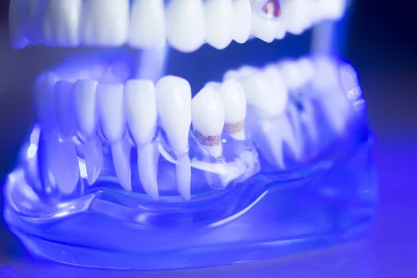 Modello di denti di allineamento dentale — Foto Stock