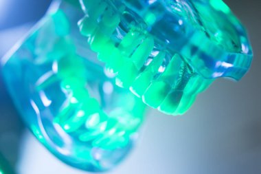 Diş ağız diş modeli