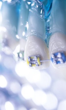 Diş diş köşeli metal