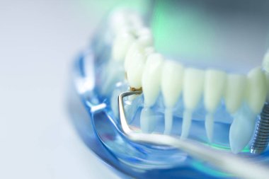 Diş diş dişçi modeli