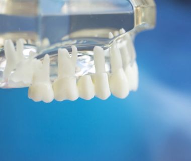 Diş diş ağız modeli