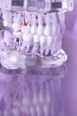 Dentsts diş diş modeli