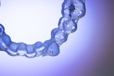 Görünmez diş aligner köşeli ayraç