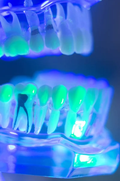 Modelo de mandíbula de dentes dentários — Fotografia de Stock