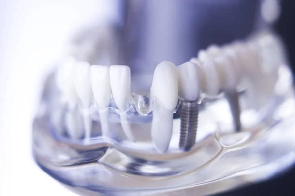 Dentstas modelo de dientes dentales — Foto de Stock